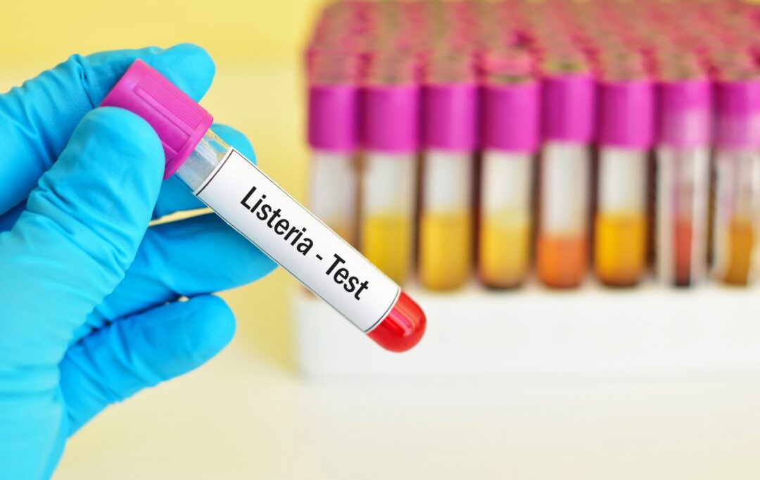 Is listeria a real concern?