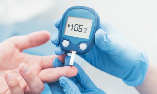 Living Minute | Is New Diabetes a Warning Sign for Pancreatic Cancer?
