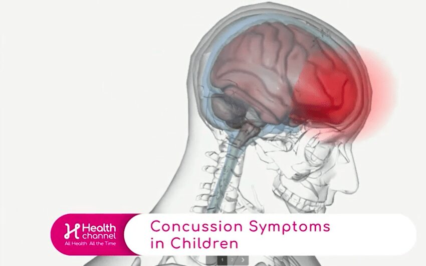 Concussions in Children: Symptoms, Health Channel