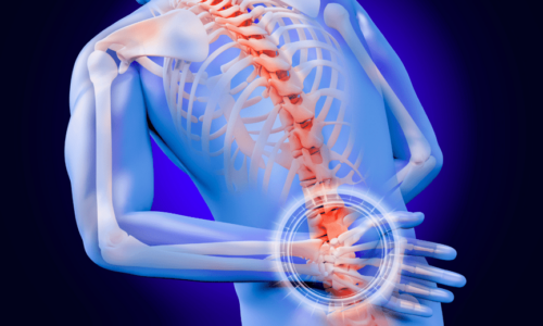 How Steroids Can Be Used to Ease Persistent Back Pain | Health Channel