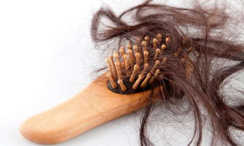 Understanding the Differences in Hair Loss Between Men and Women